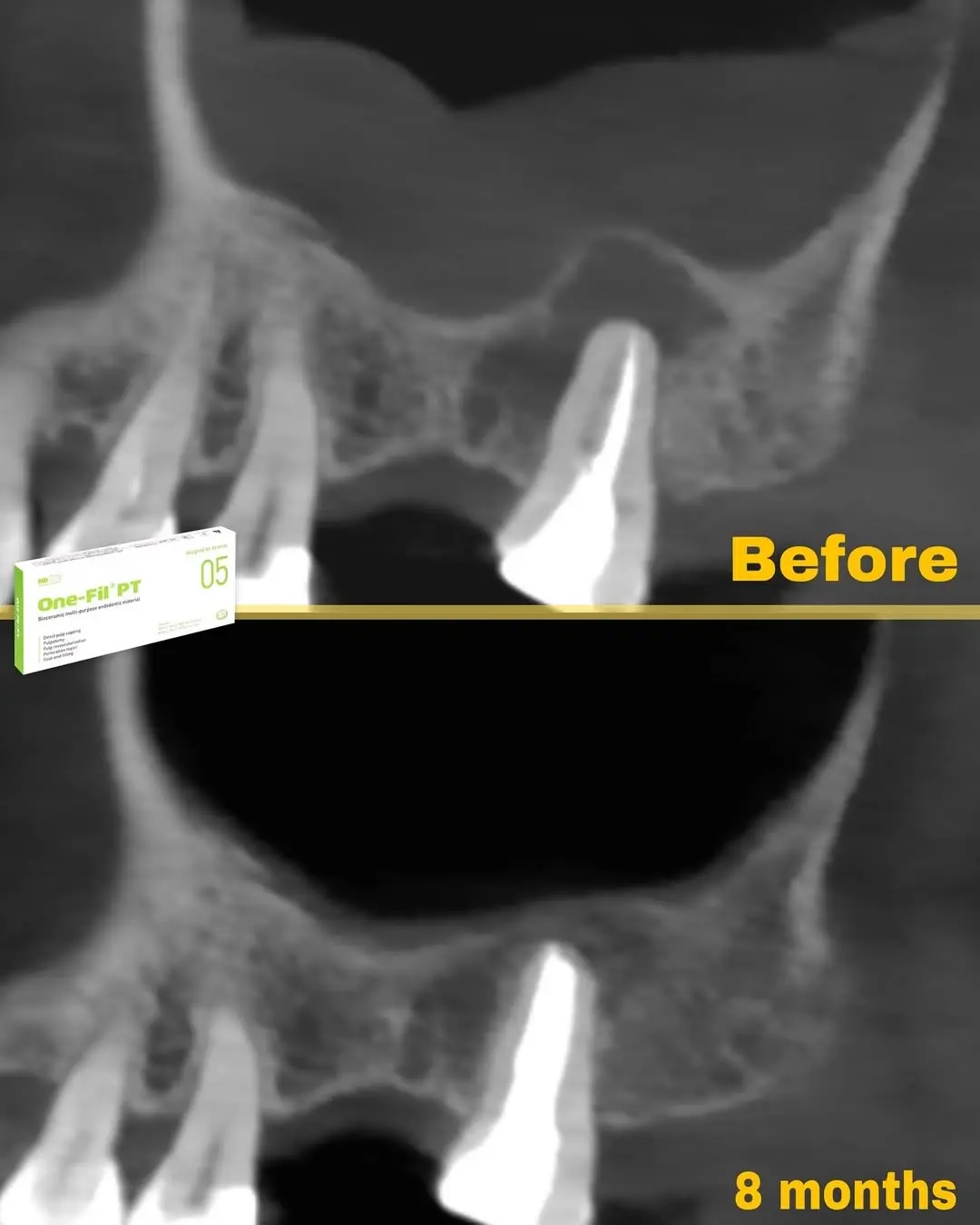 Before Image
